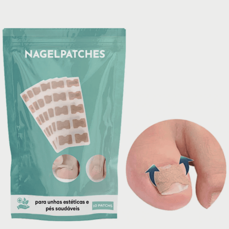 NagelPatches™ | Gesso corretivo para unhas bonitas e saudáveis